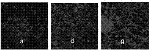 Method for inductively differentiating umbilical cord mesenchymal stem cells into oligodendroglia cells