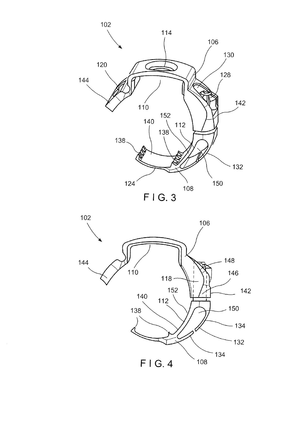 Bone Fracture Fixation Clamp with Bone Remodeling Adaptability