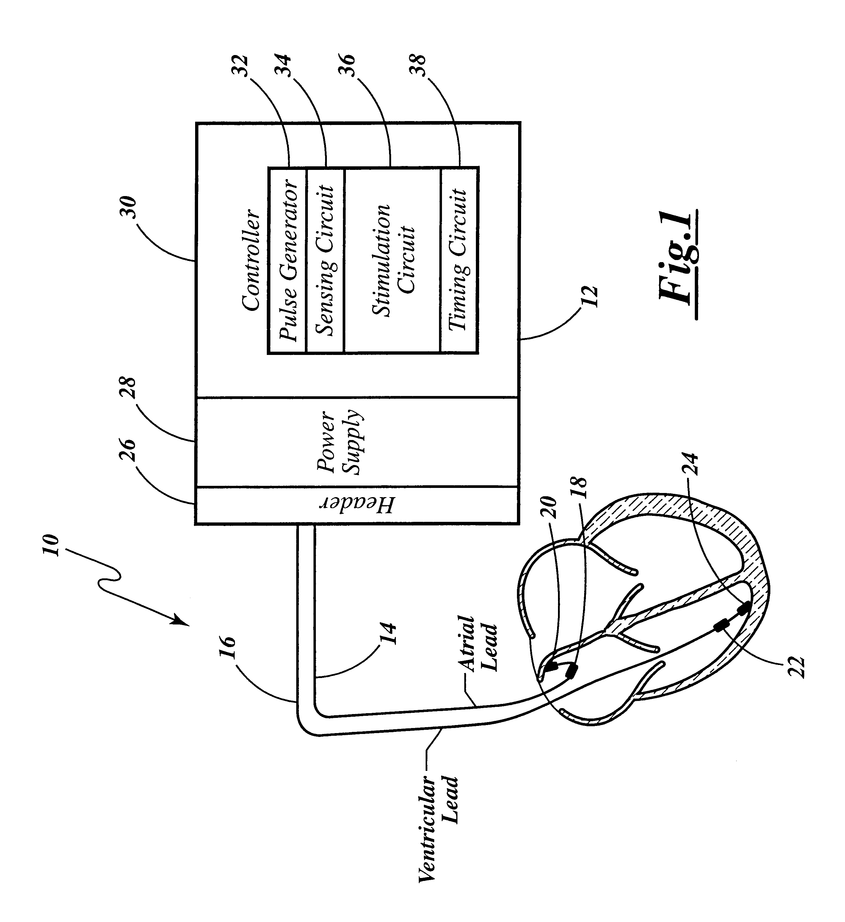 Cardiac management device with capability of noise detection in automatic capture verification