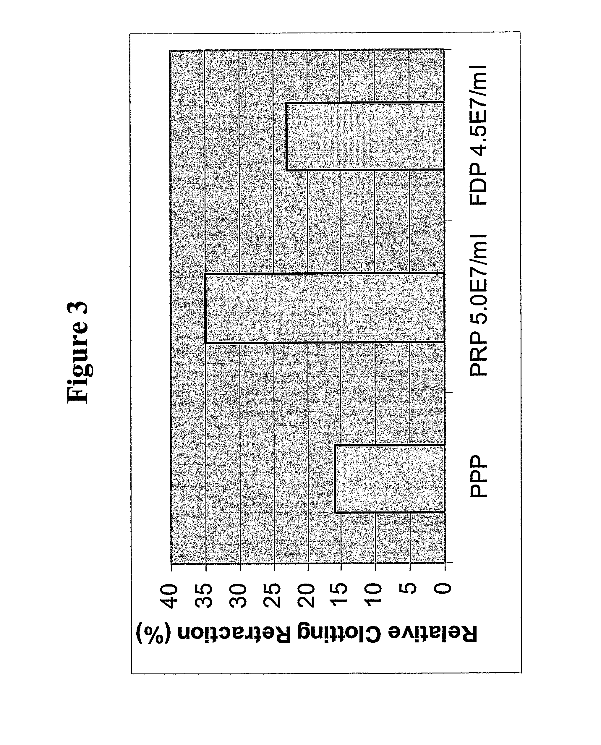 Methods for preparing freeze-dried platelets, compositions comprising freeze-dried platelets, and methods of use
