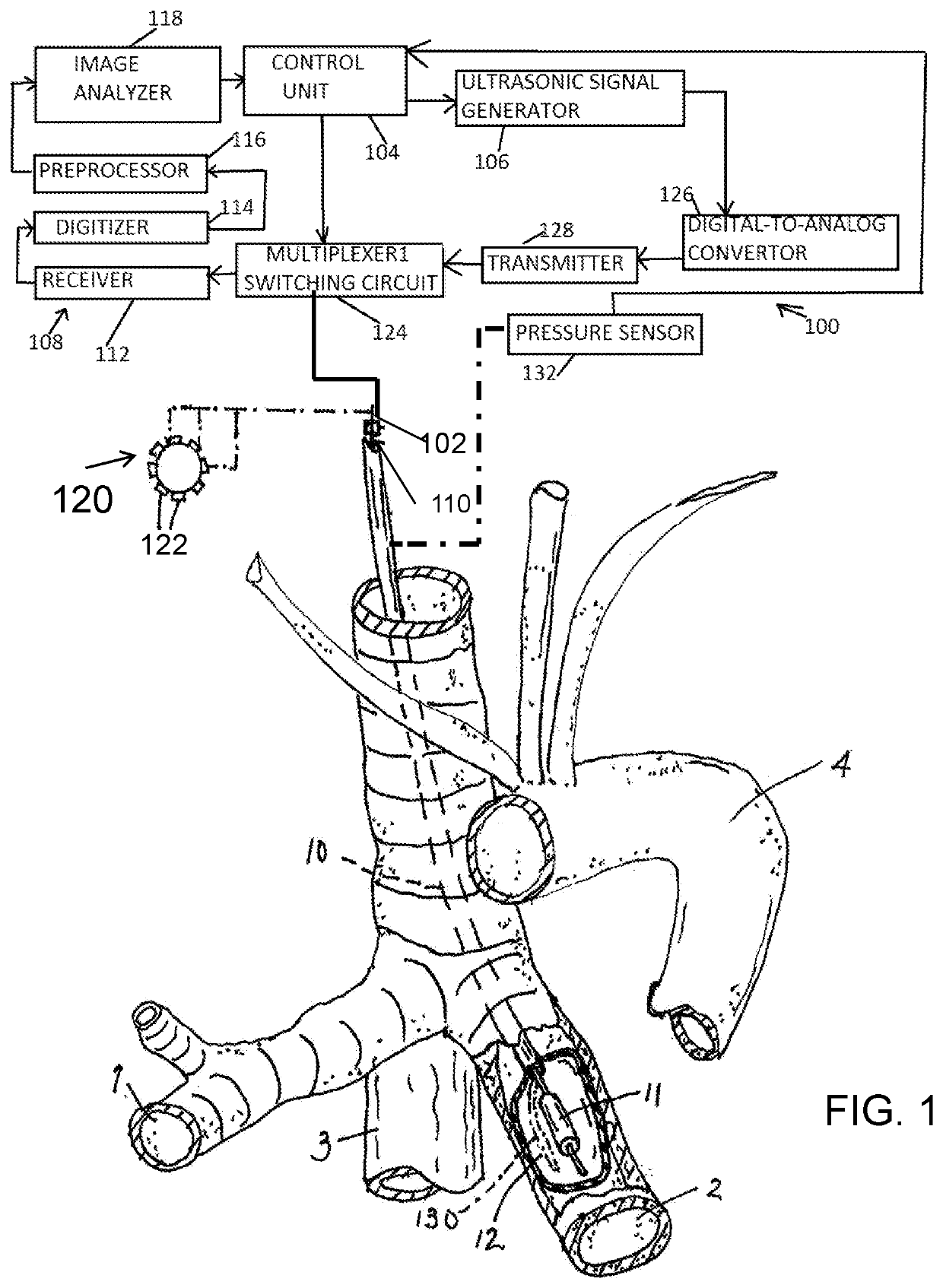 Method and apparatus for performance of thermal bronchioplasty to reduce COVID-19-induced respiratory distress and treat COVID-19-damaged distal lung regions