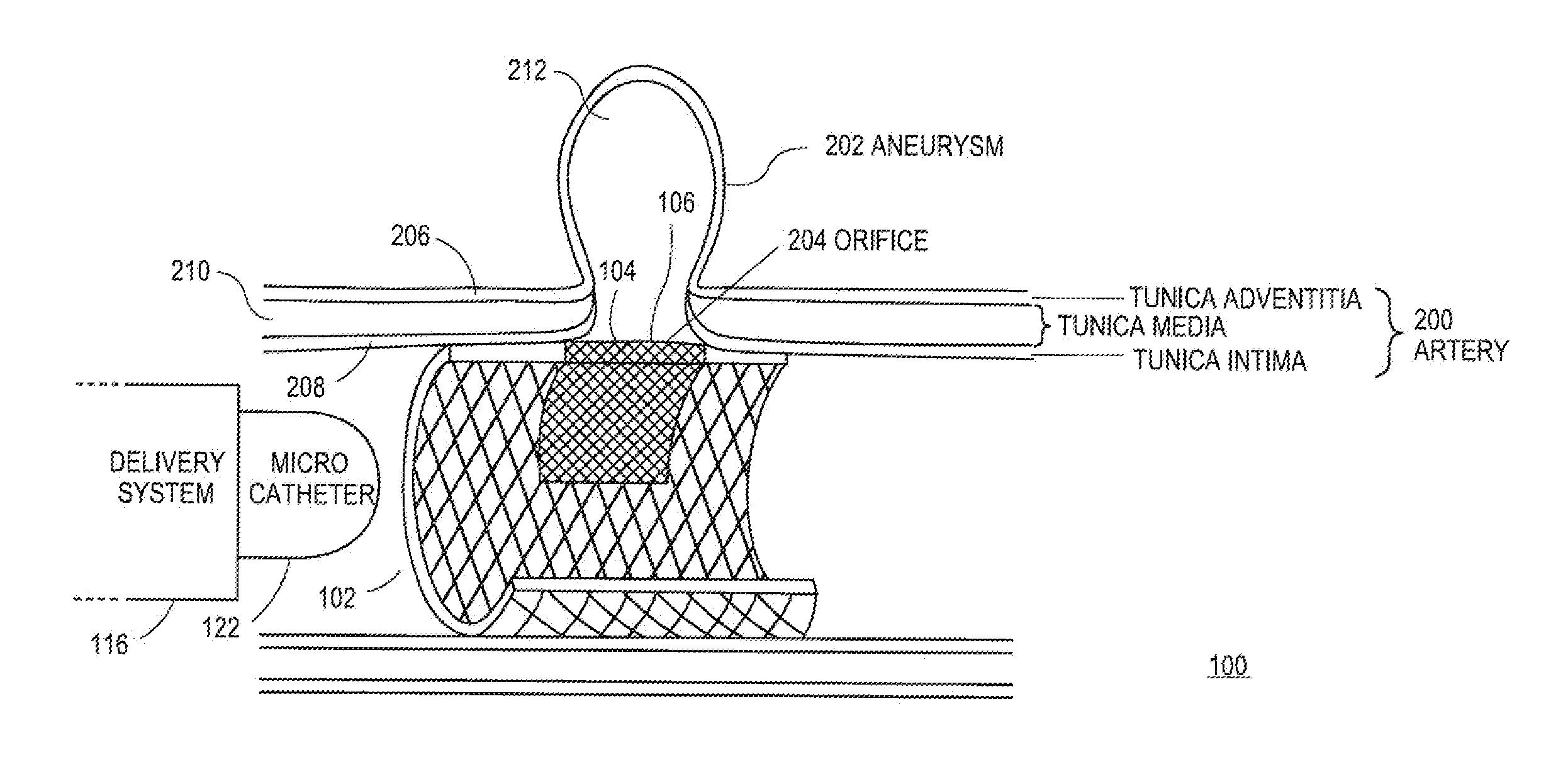 Systems and Methods for Magnetized Stent Having Growth-Promoting Properties