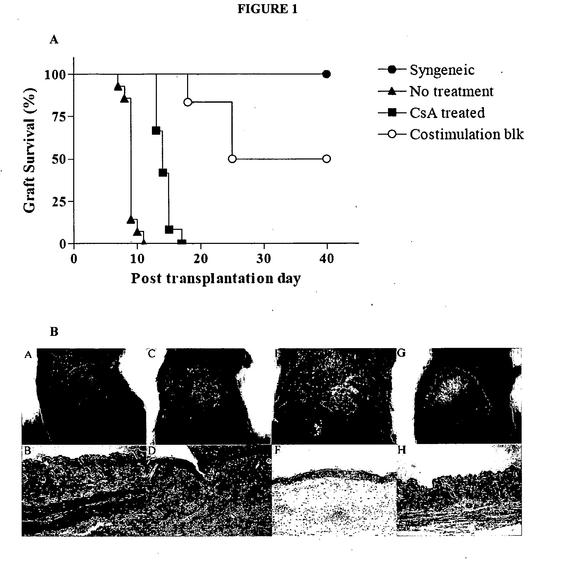 Systems and methods for monitoring immune responses and predicting outcomes in transplant recipients