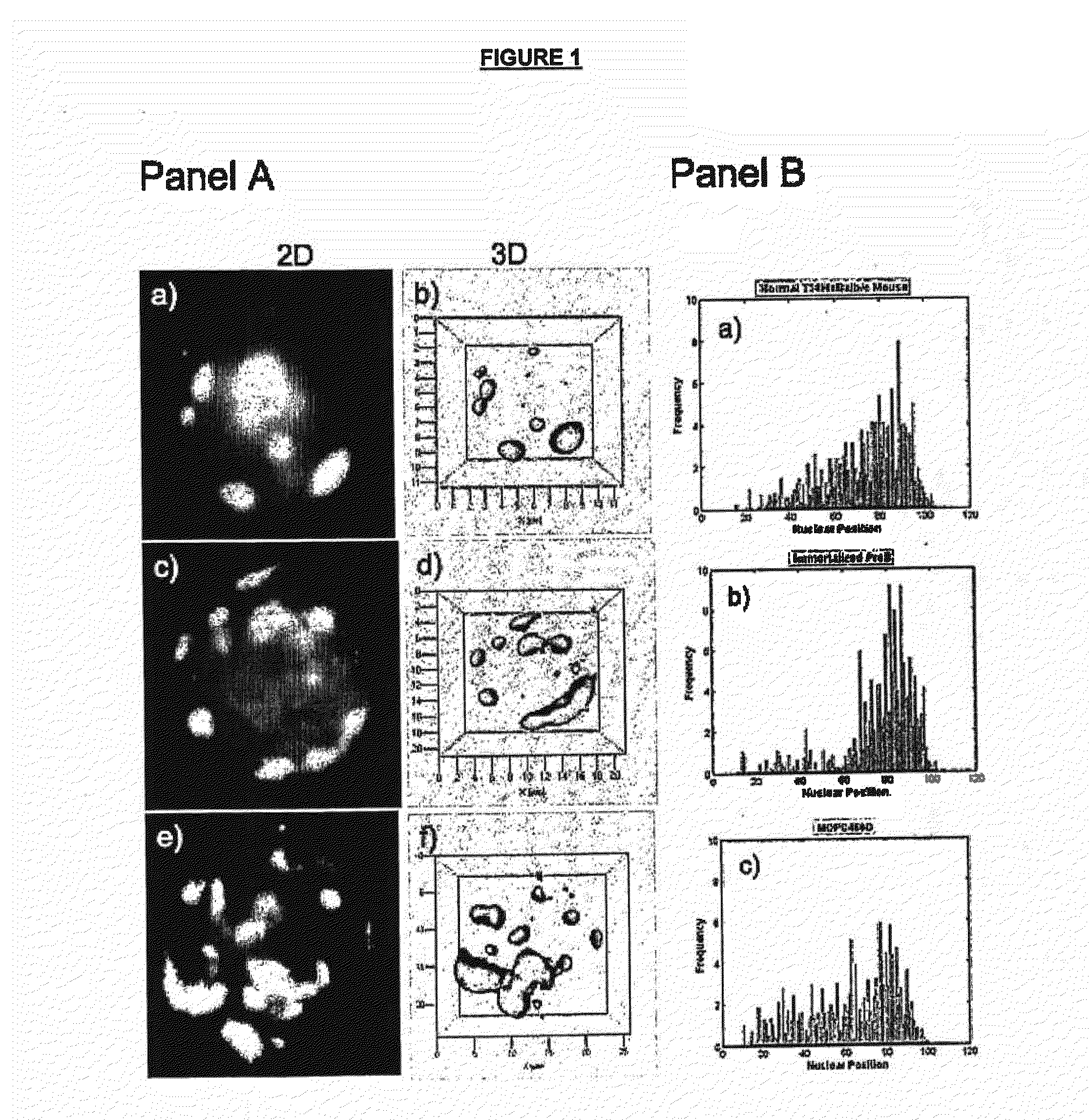 Methods of Detecting and Monitoring Cancer Using 3D Analysis of Centromeres