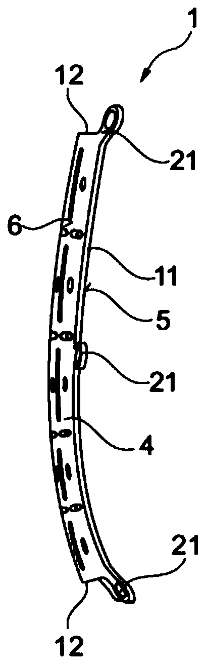 Bone implant for attaching to surface of bone