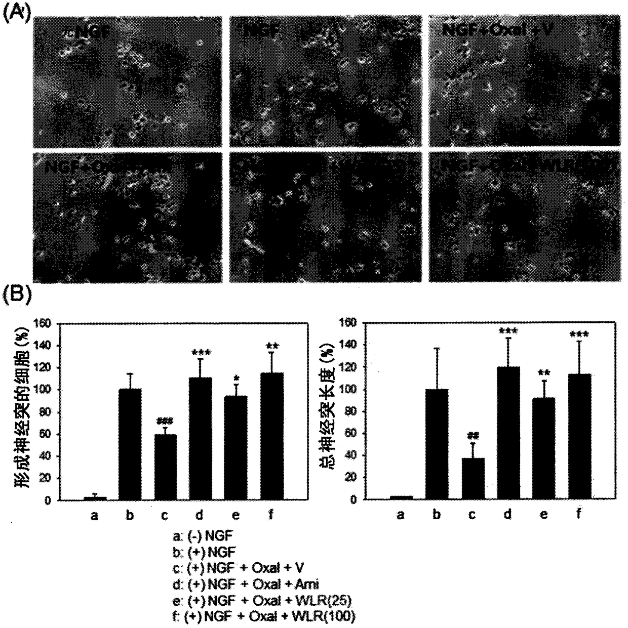 Composition, containing lithospermi radix extract as active ingredient, for preventing, alleviating, or treating peripheral neuropathy