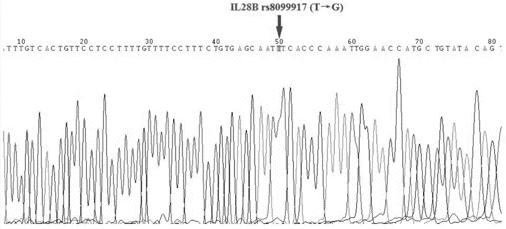 Primers, kit and method for detection of polymorphism of human IL28B gene