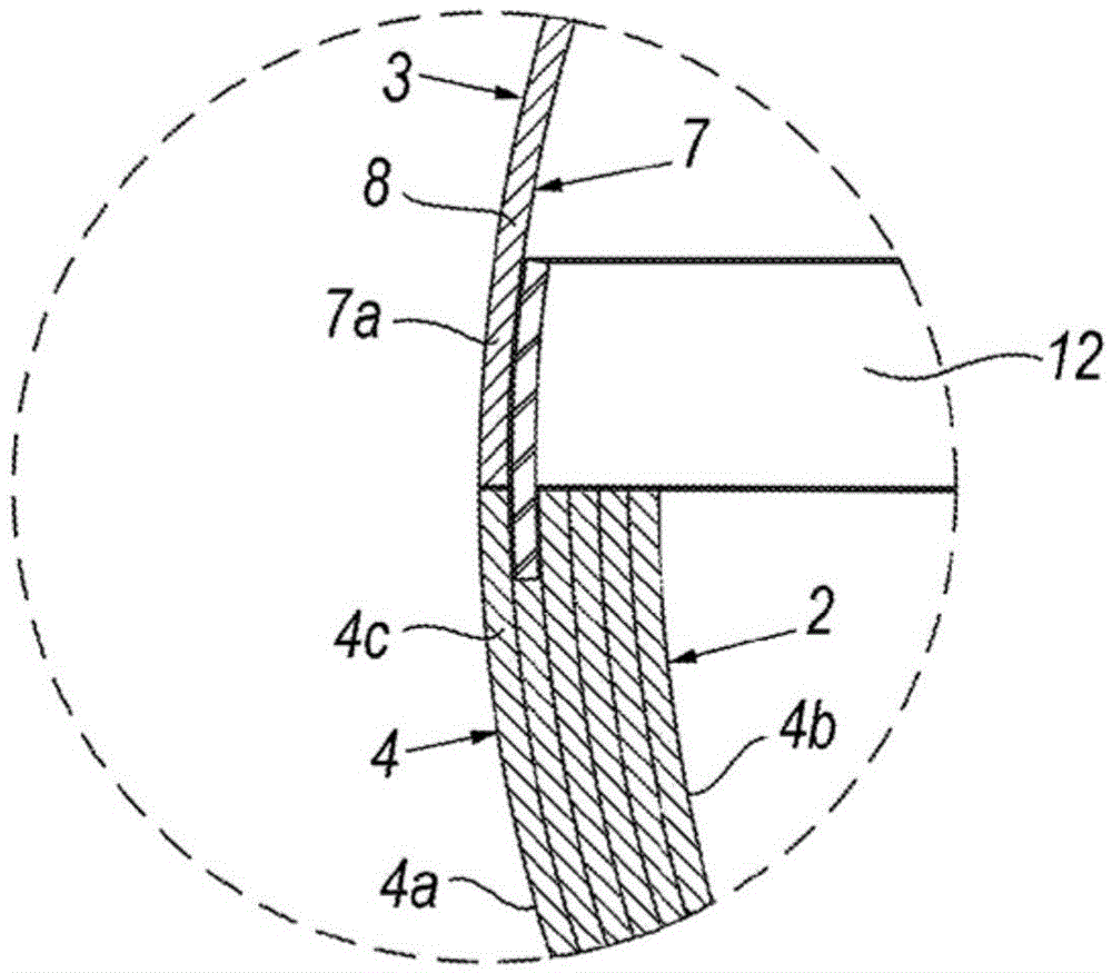 in situ artificial bladder prosthesis