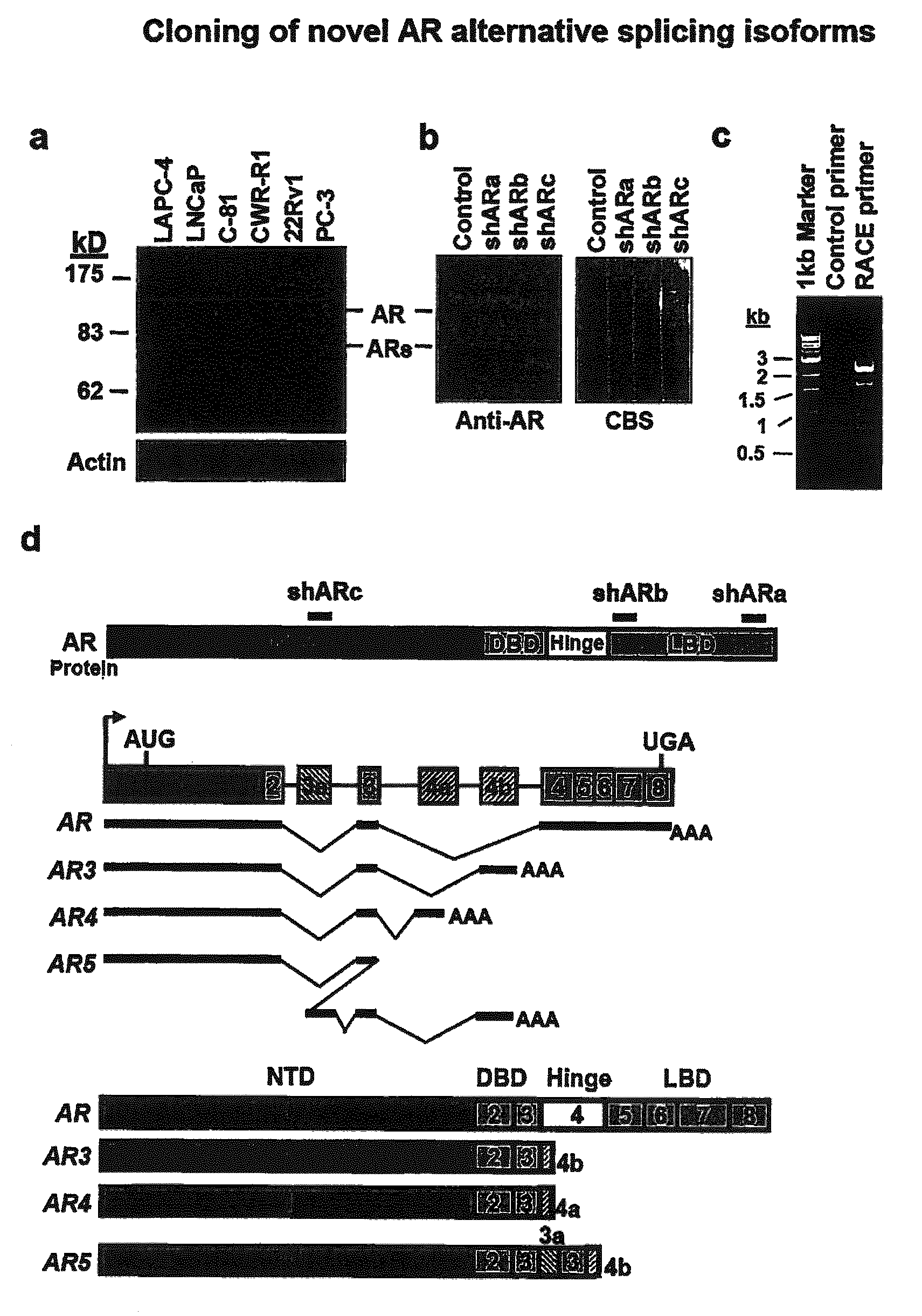 Human androgen receptor alternative splice variants as biomarkers and therapeutic targets