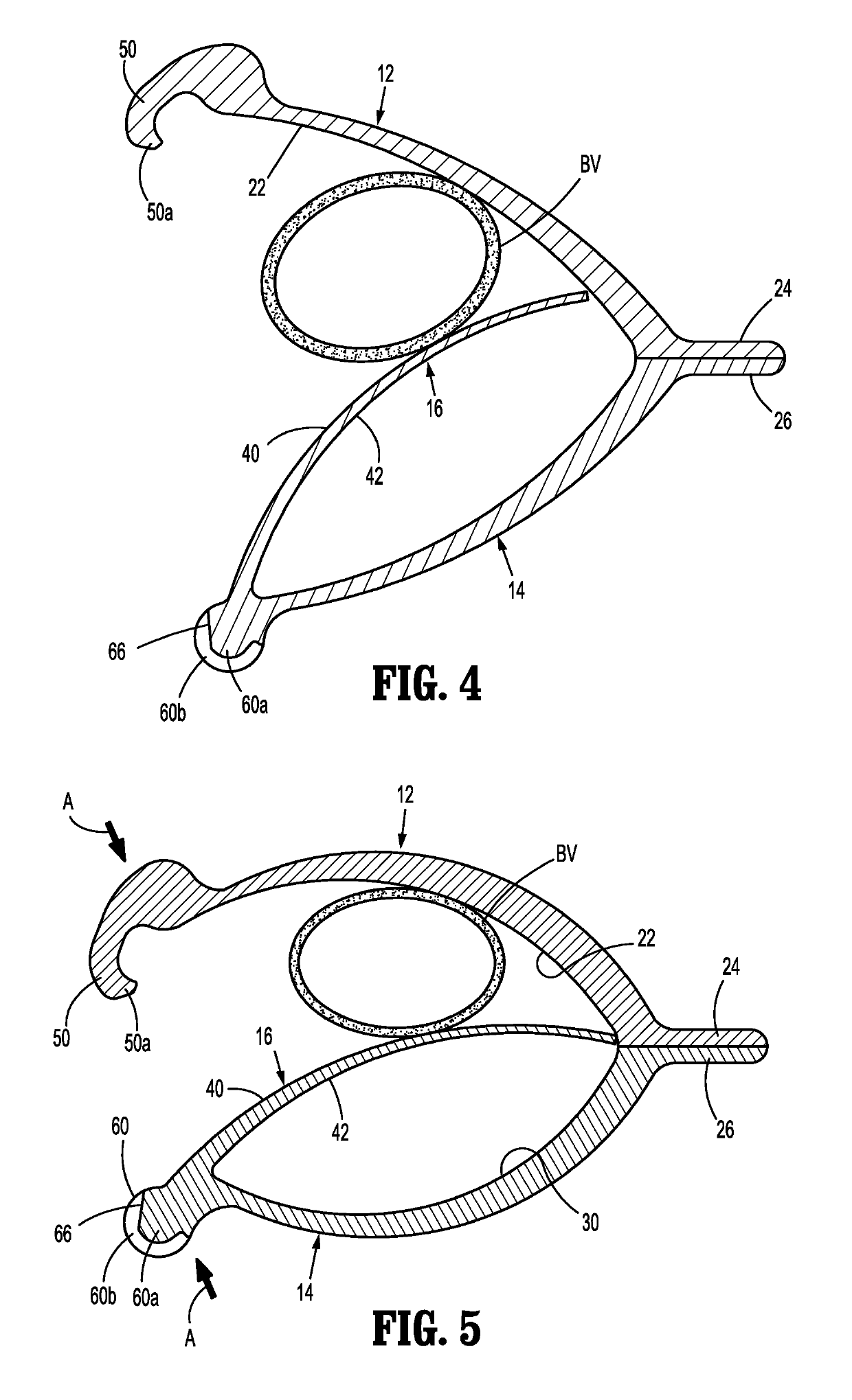 Ligation clip with controlled tissue compression