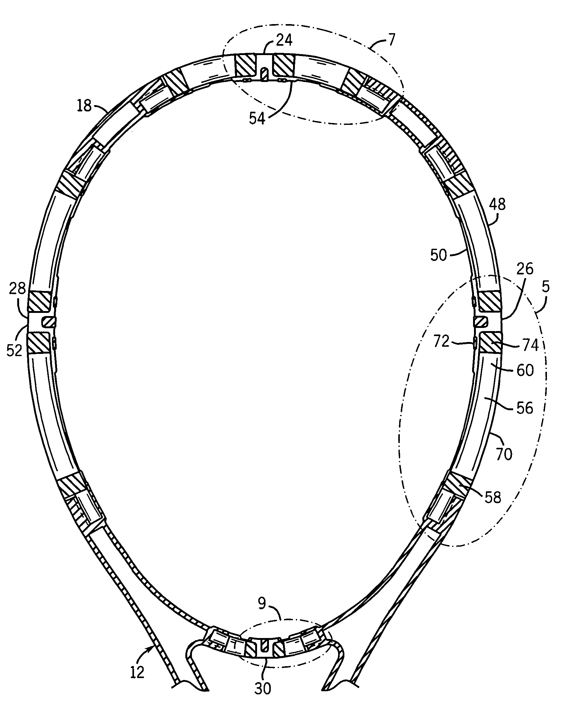 Racquet having cantilevered hoop portions