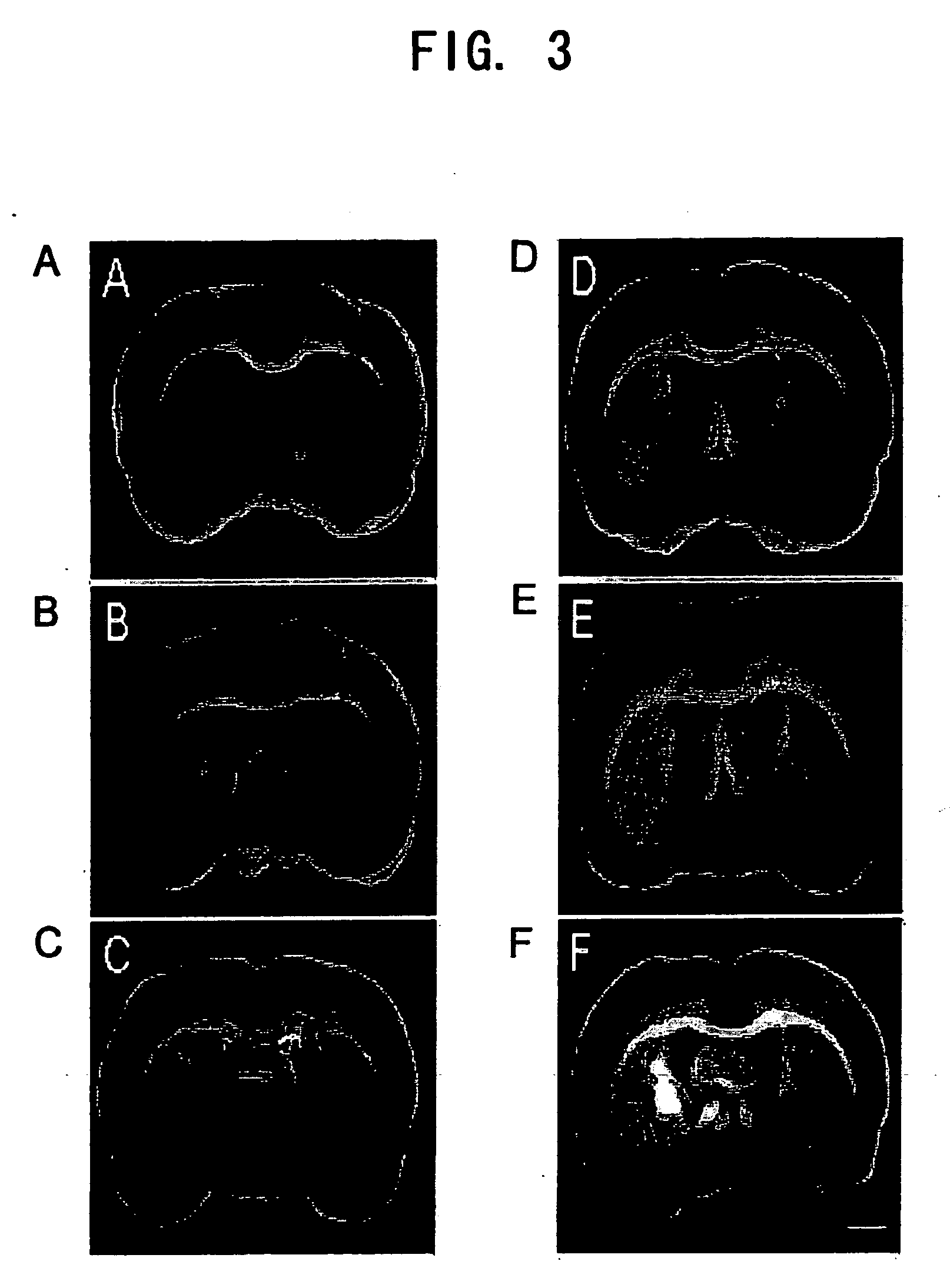 Internally administered therapeutic agents for cranial nerve diseases comprising mesenchymal cells as an active ingredient