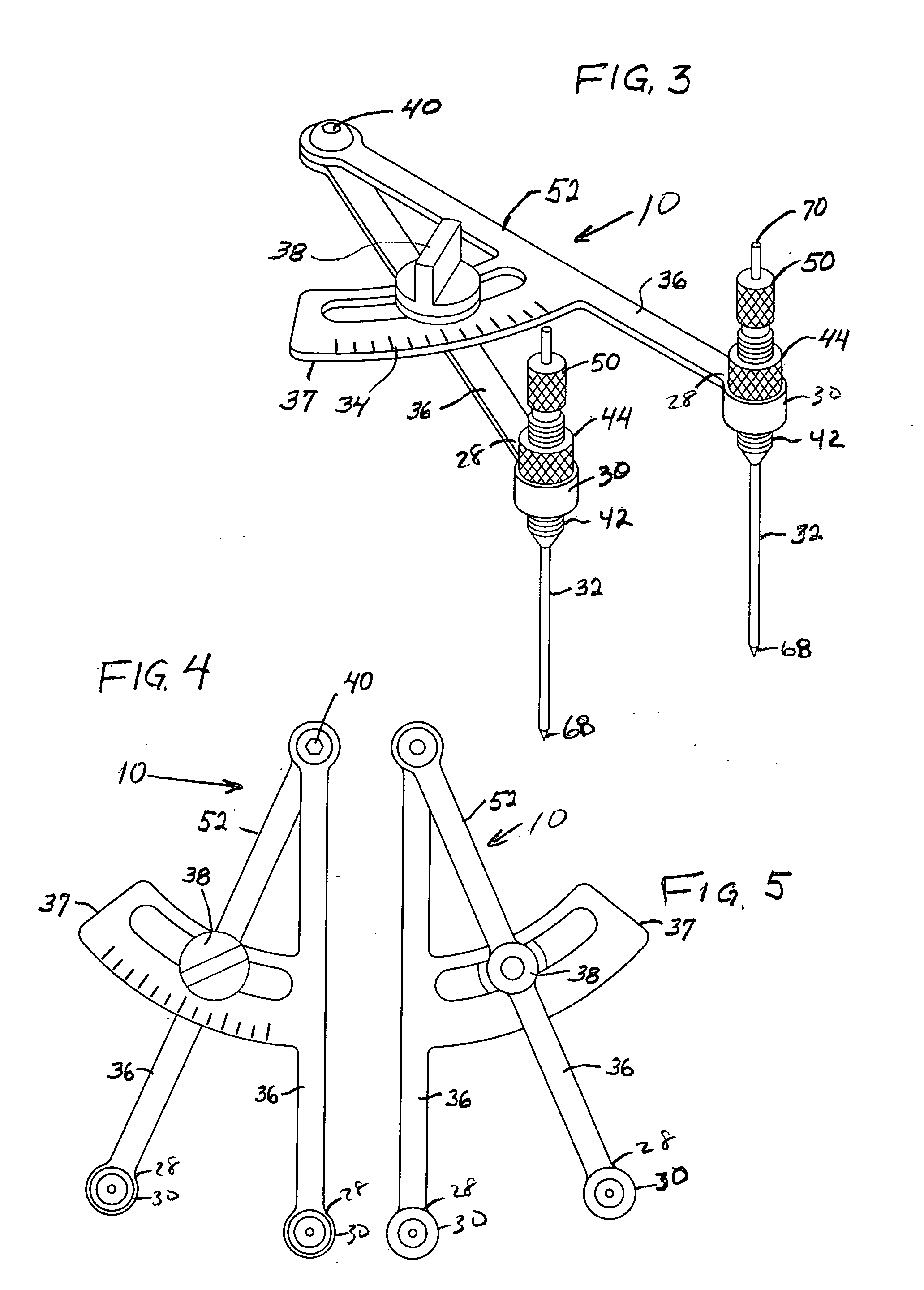 Extracapsular surgical procedure and surgical referencing instrument therefor