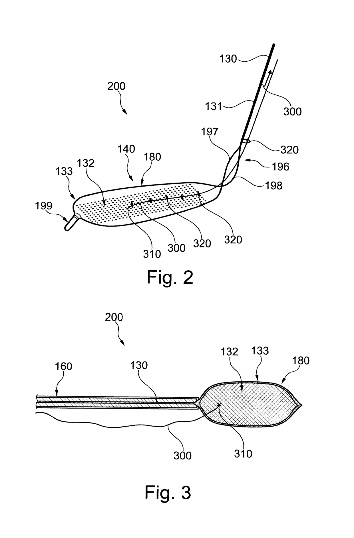 Embolic protection device and method