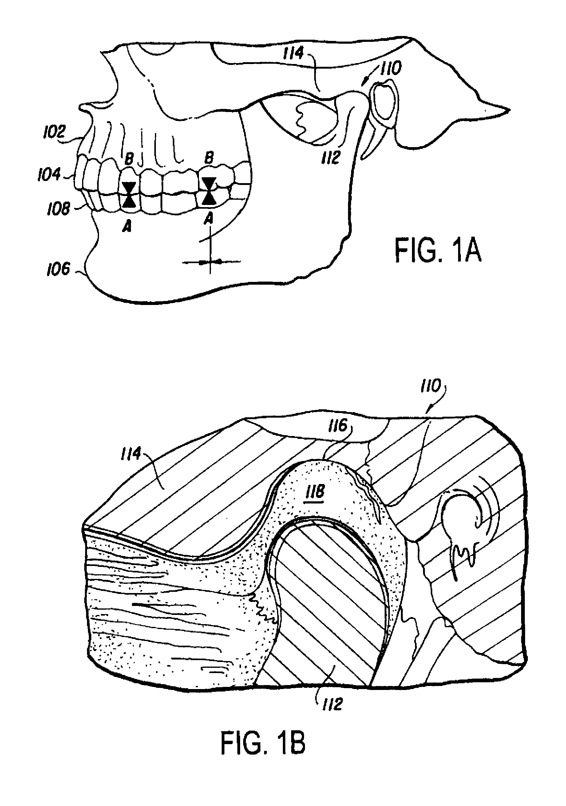 Physical rehabilitation and training aid: method of using musculoskeletal repositioning device