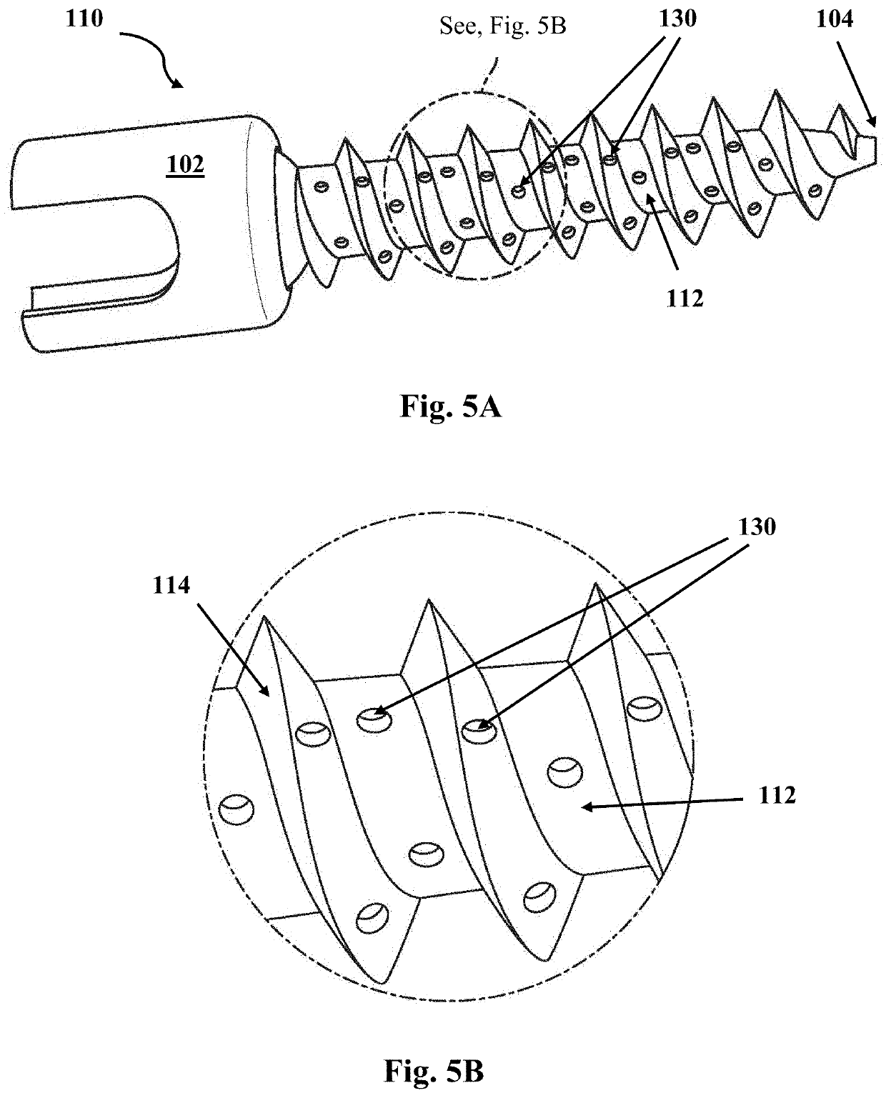 Fasteners and system for providing fasteners in bone
