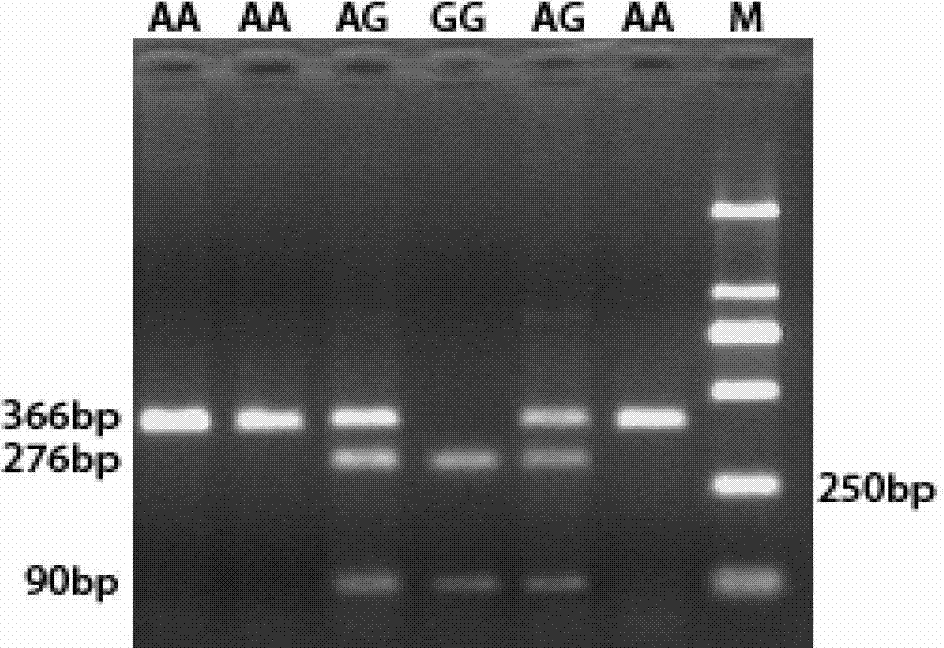 SNP molecular marker related to pig carcass trait and application thereof