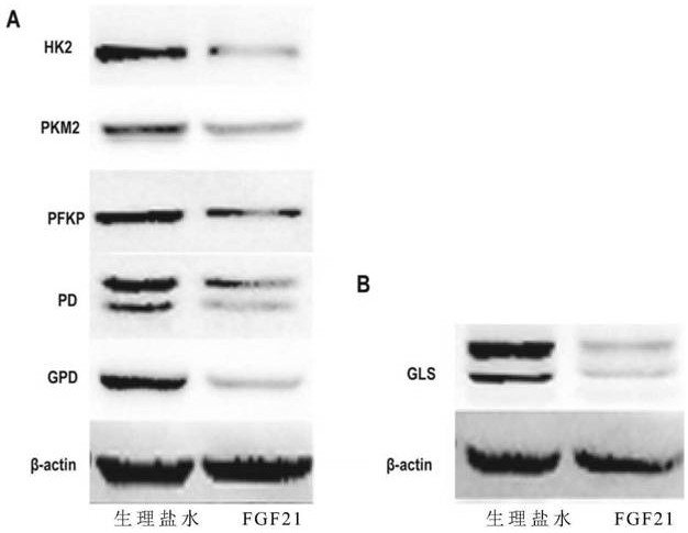 Application of fgf21 in preparation of medicine for treating colorectal cancer