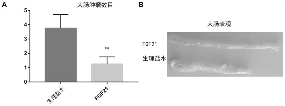 Application of fgf21 in preparation of medicine for treating colorectal cancer