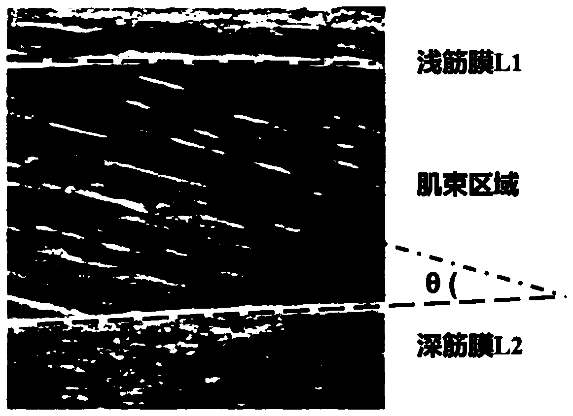 Method and system for automatically measuring structural angle in muscle tissue