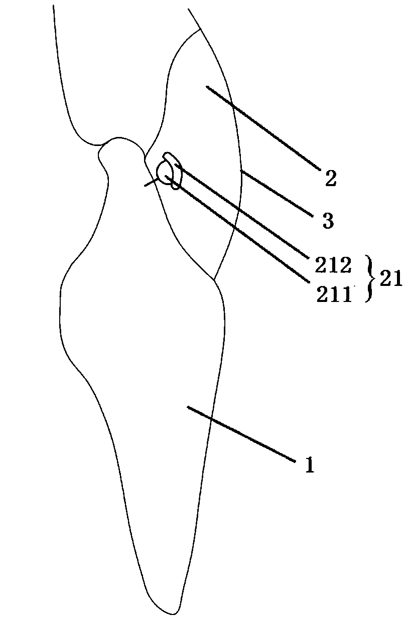 Fixing false tooth false gingiva attachment body and manufacturing method thereof