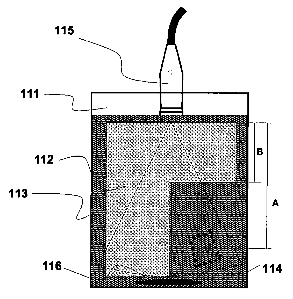 Gas- Filled Microvesicles Composition for Contrast Imaging