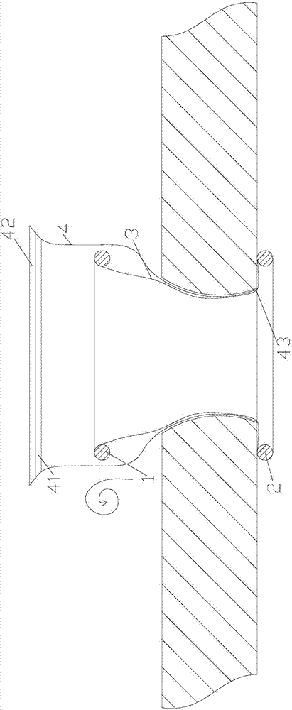 Surgical abdominal cavity closure device