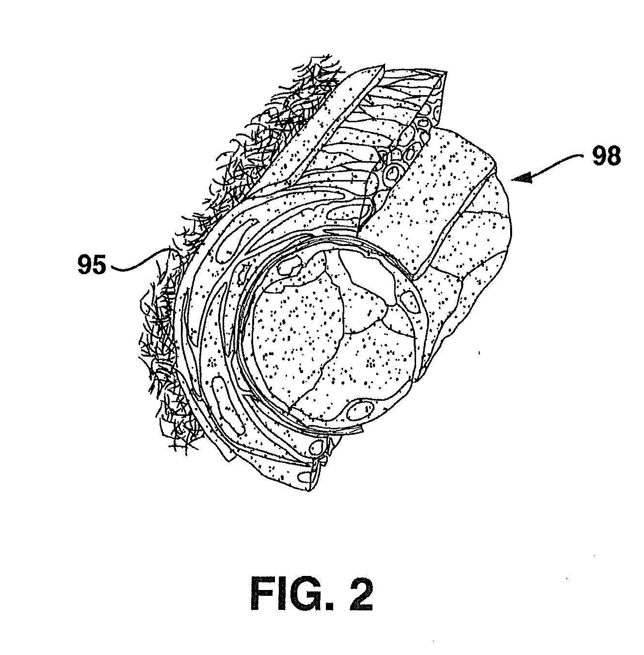 Compliant Blood Vessel Graft