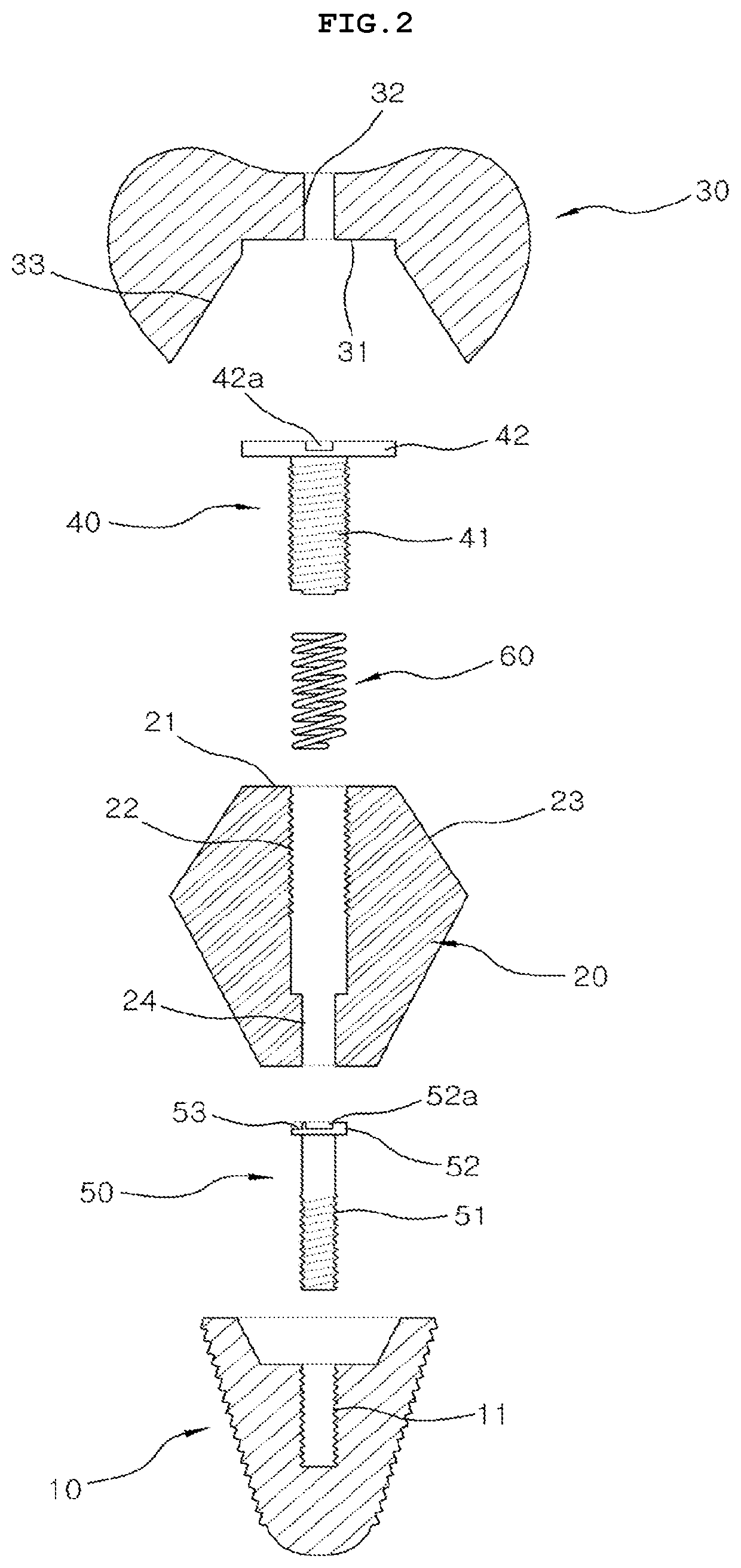 Dental implant