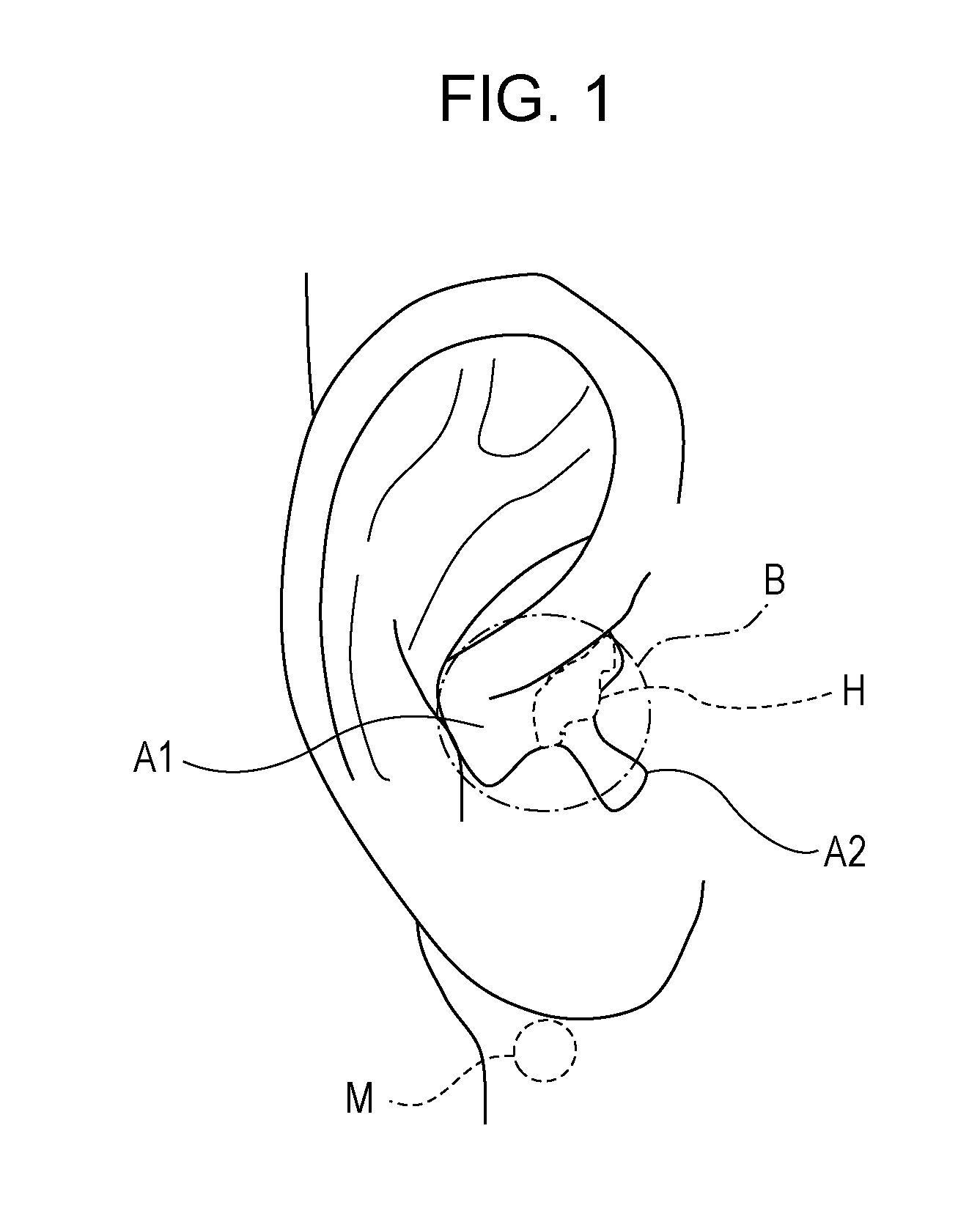 Determination system, control signal output system, rehabilitation system, determination method, control signal output method, and recording medium