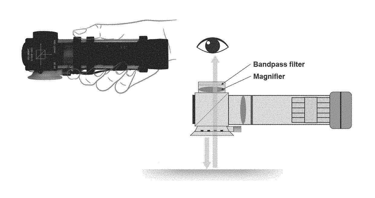 Handheld blood-flow imaging device