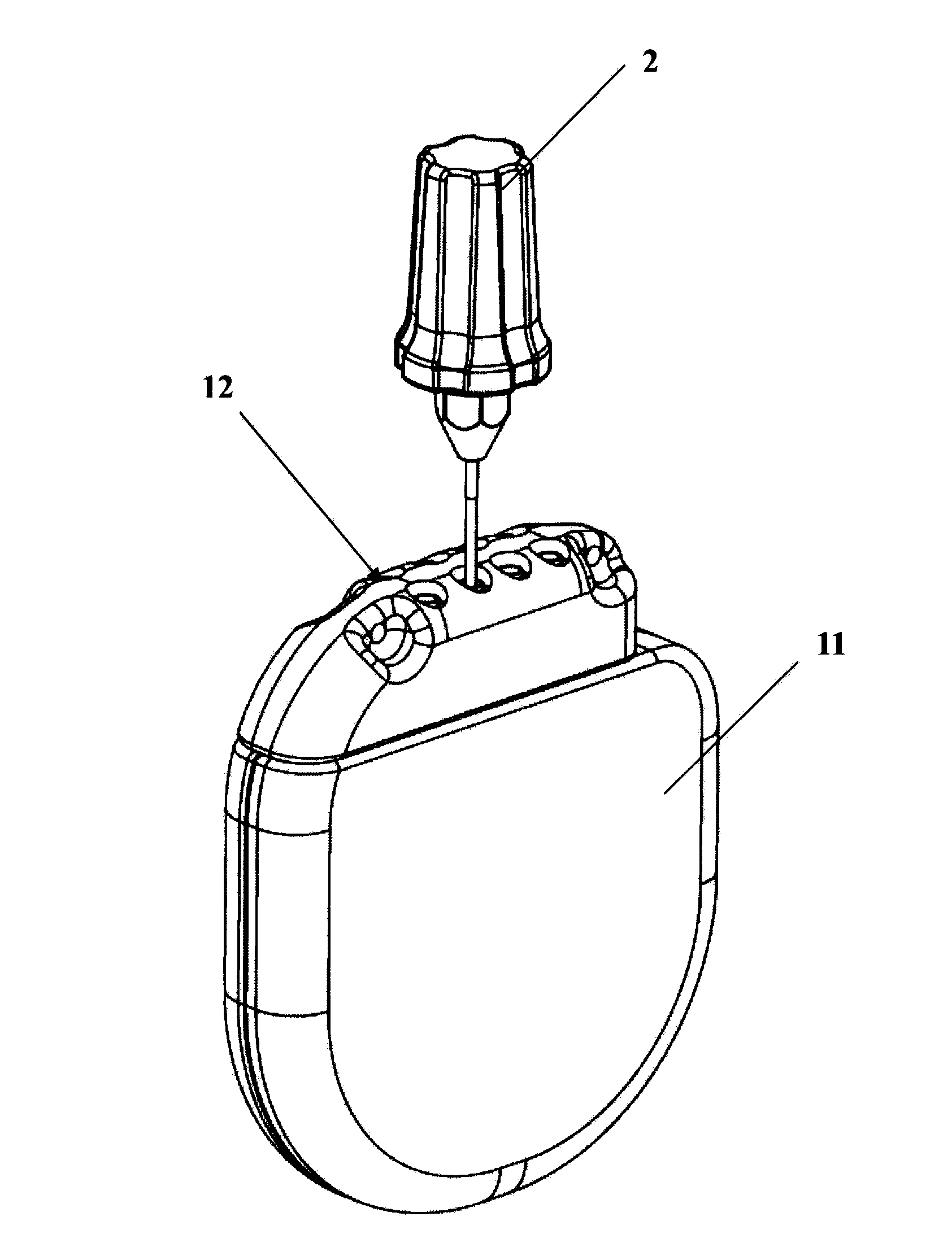 Implantable medical device and system with structure for preventing screw-out of screws