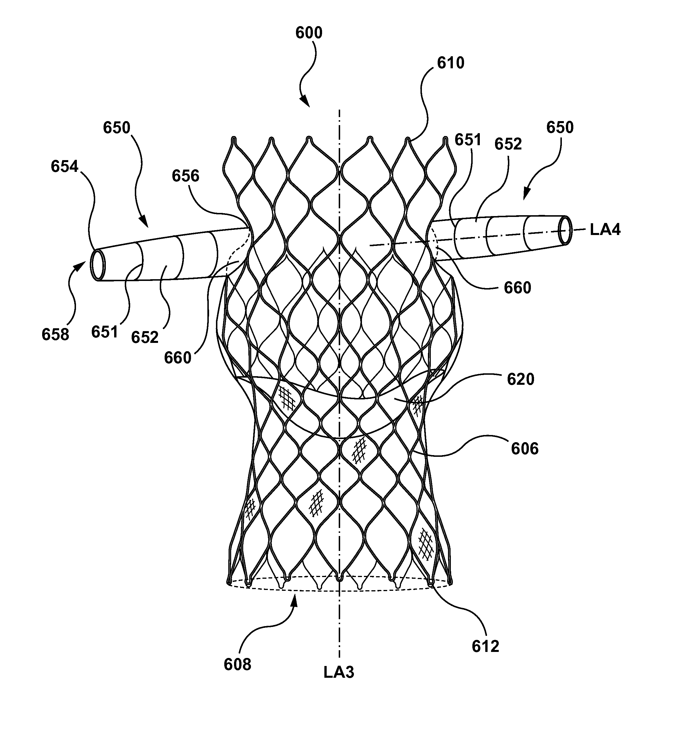 Stent assemblies including passages to provide blood flow to coronary arteries and methods of delivering and deploying such stent assemblies