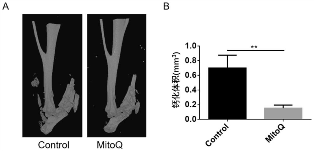 Application of Mitoquinone in preparation of medicine for preventing and/or treating sport injury