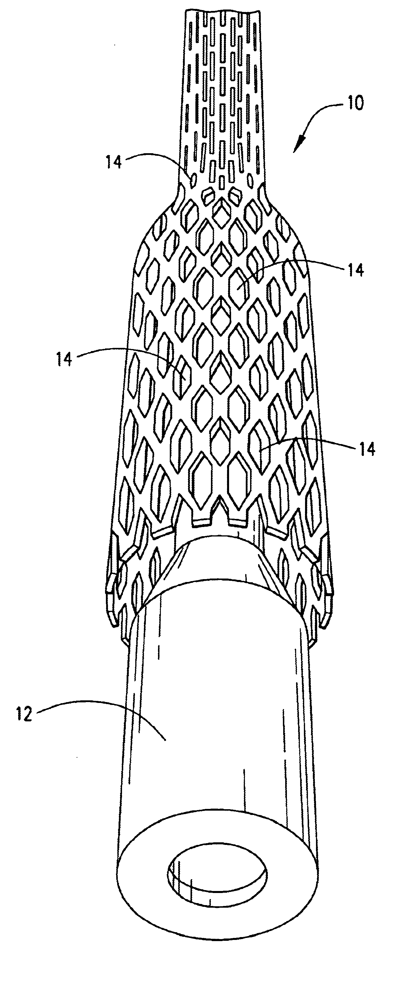 Methods and compositions for forming permeable cement sand screens in wells