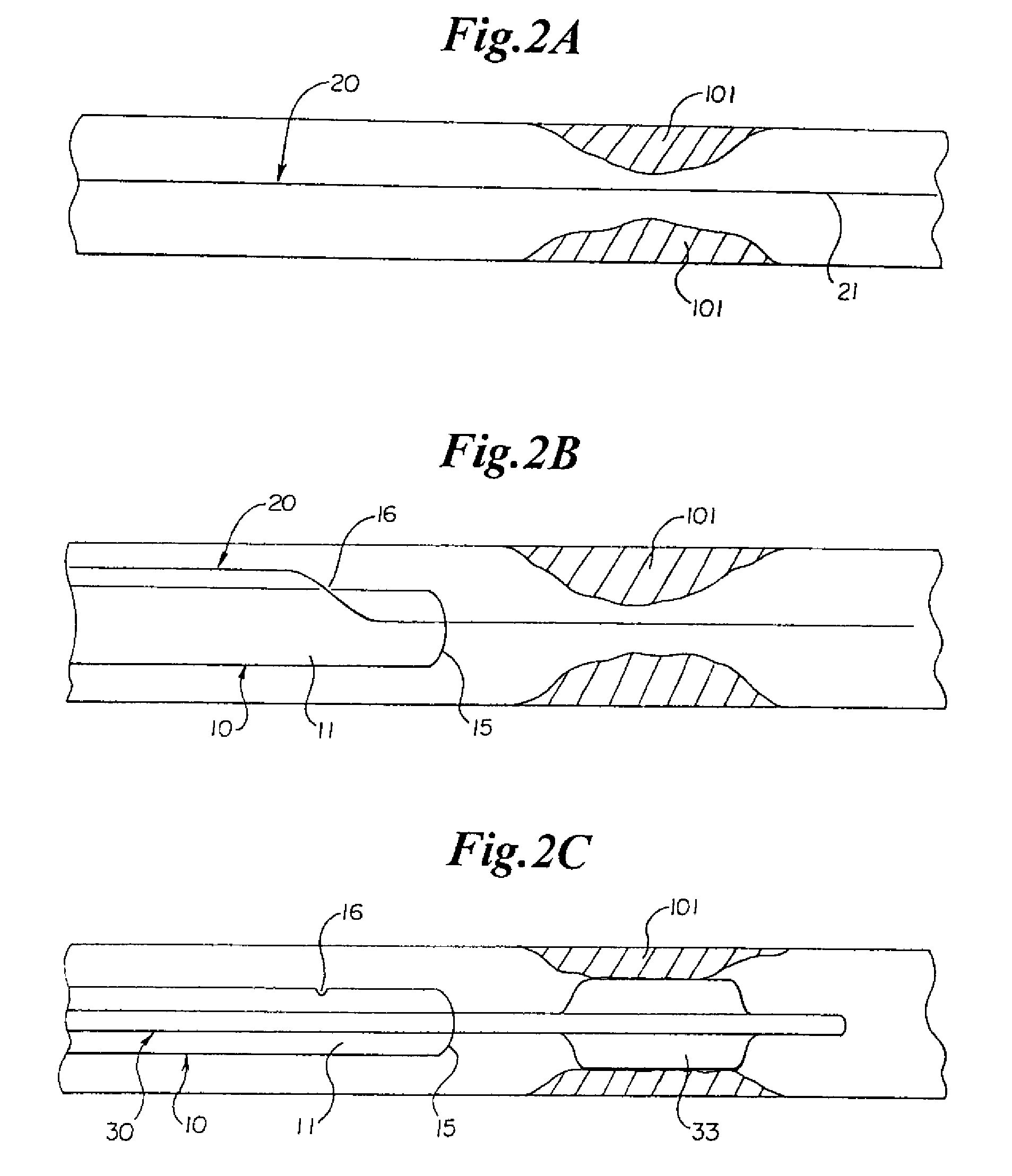 Rapid exchange sheath for deployment of medical devices and methods of use