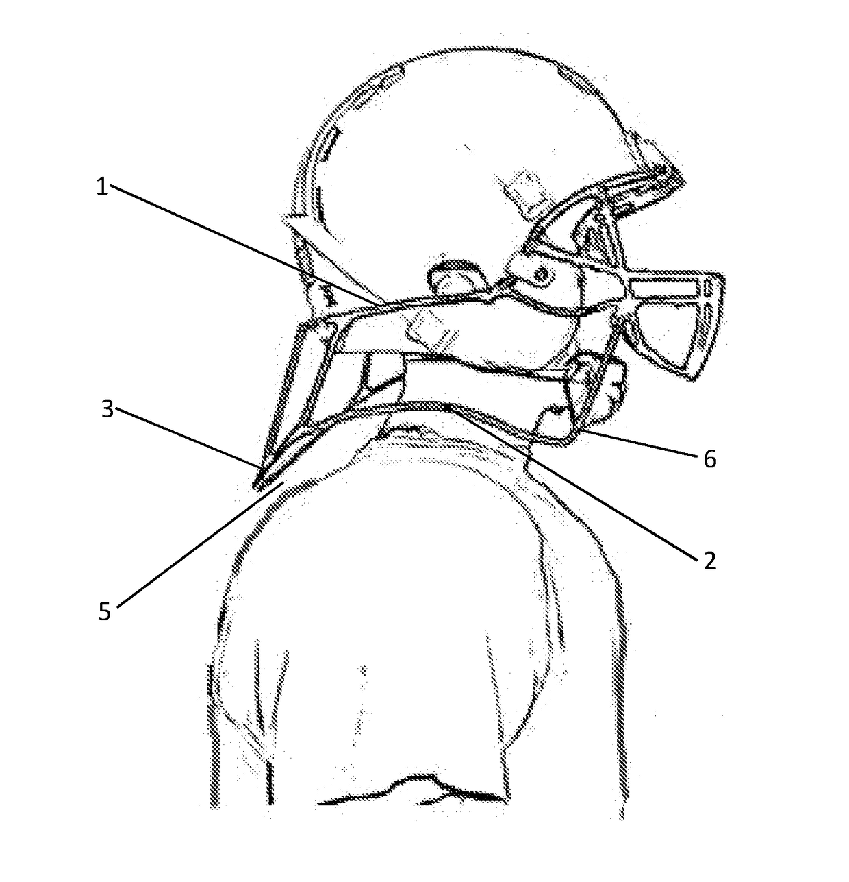 Concussive Reduction Helmet Attachment(s) Translational Axial Rotation Control and Bracing System (TARCBS).