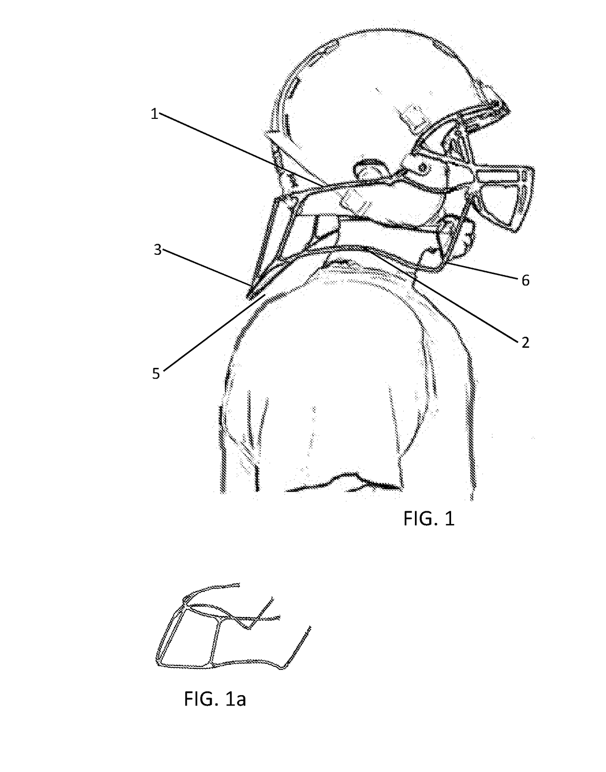Concussive Reduction Helmet Attachment(s) Translational Axial Rotation Control and Bracing System (TARCBS).