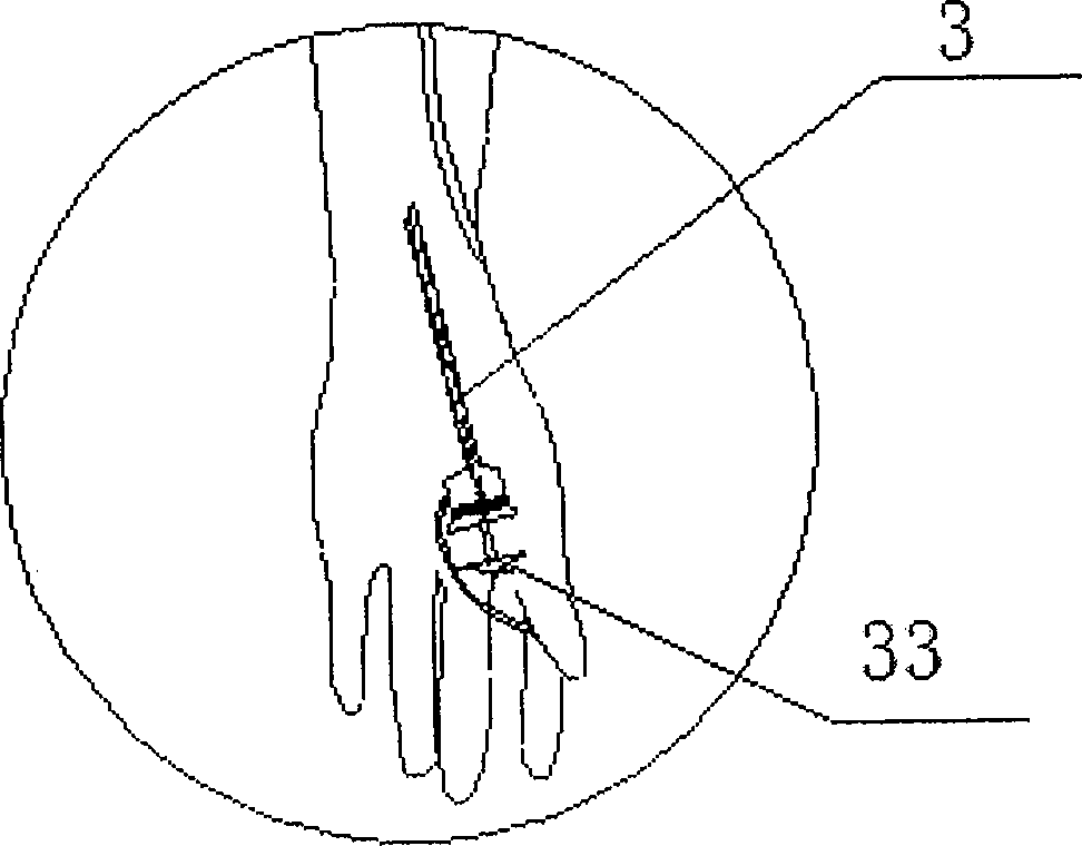 Puncture method of artery puncture needle for invasive arterial blood pressure monitoring