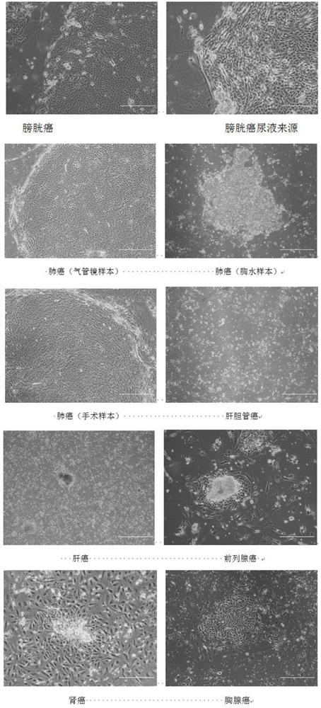Primary tumor cell culture medium, culture method and application
