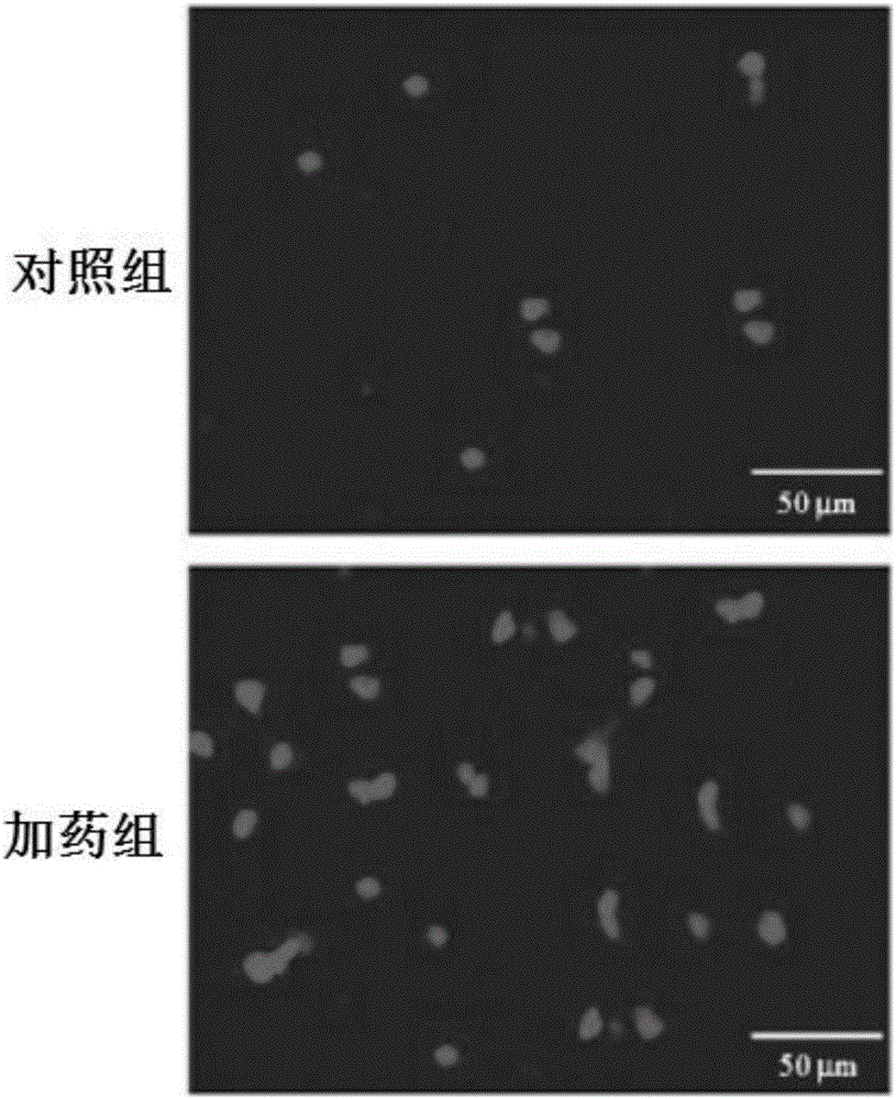 Culture method for promoting proliferation and differentiation of neural stem cells