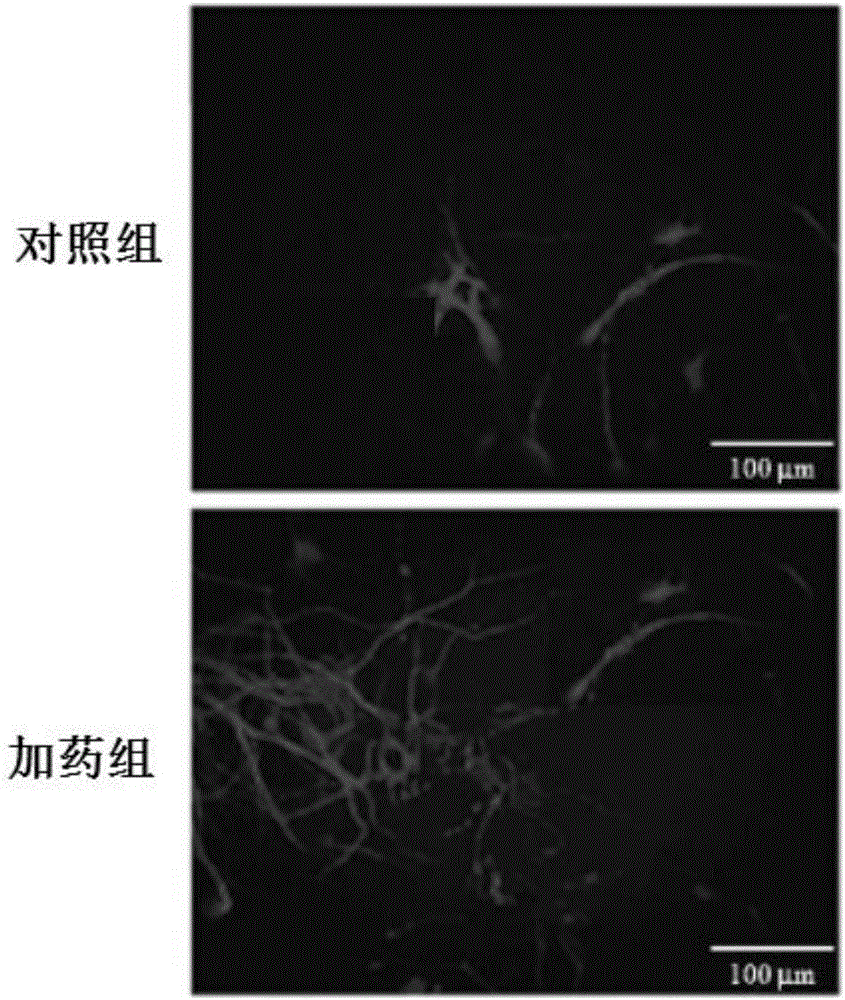 Culture method for promoting proliferation and differentiation of neural stem cells