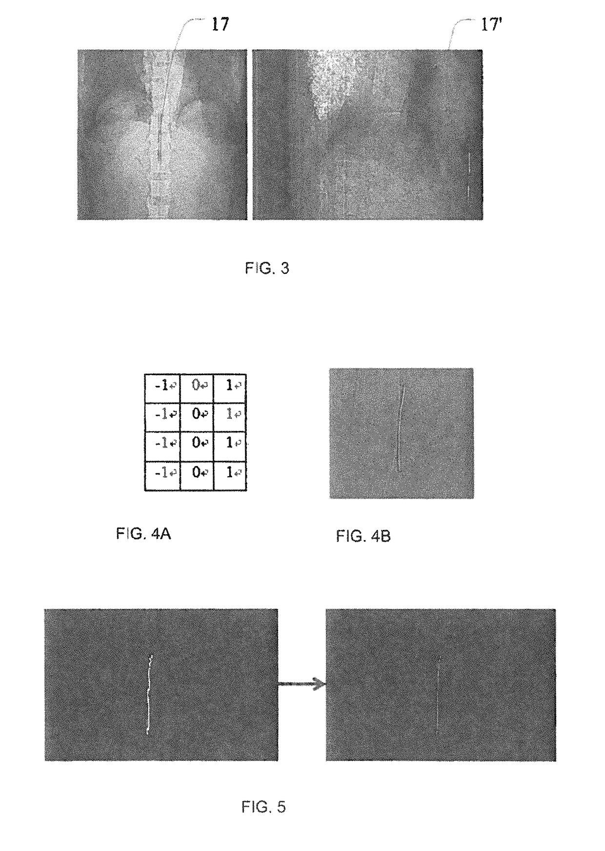 Method and apparatus for navigating CT scan with a marker