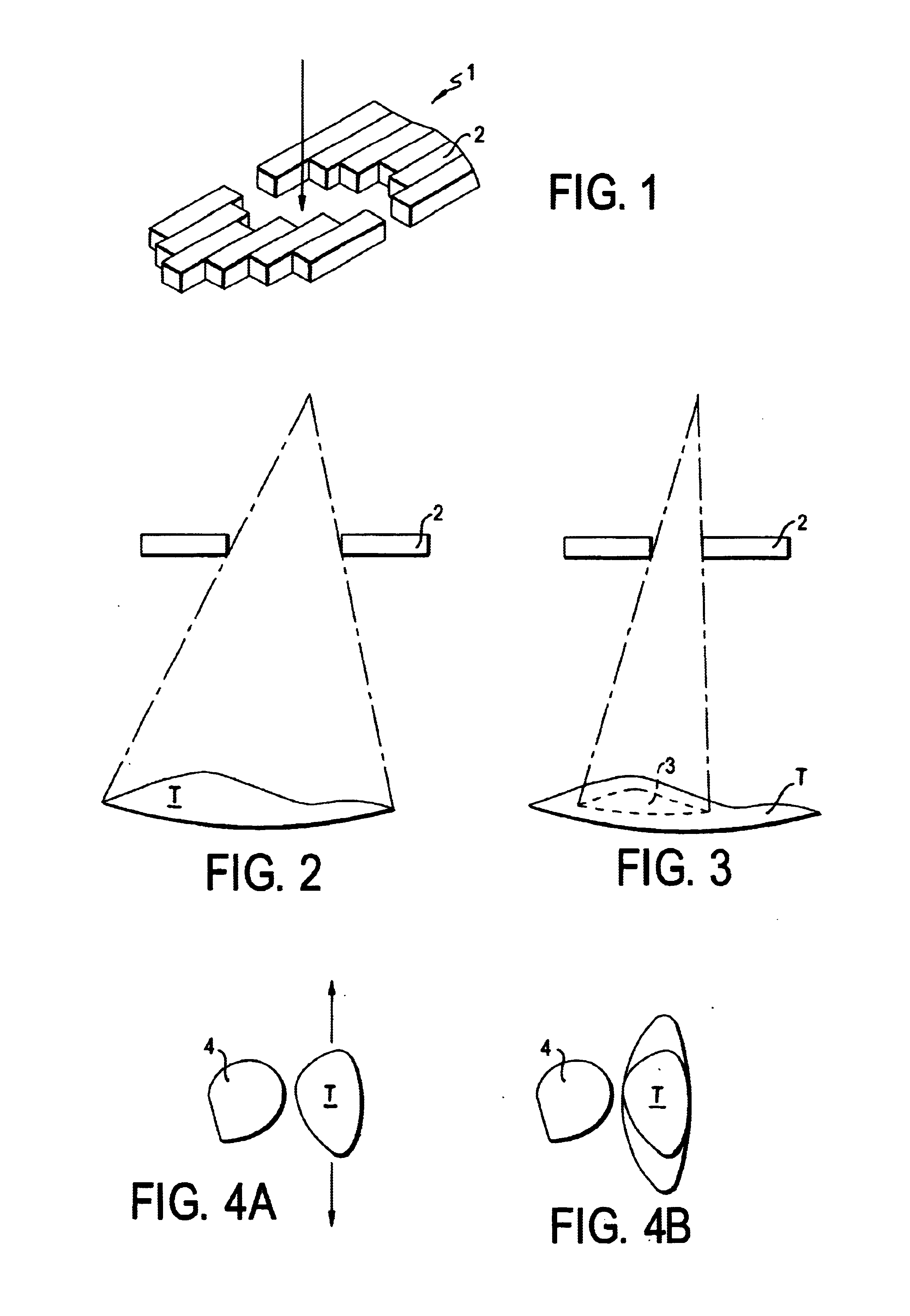 Method to control delivery of radiation therapy