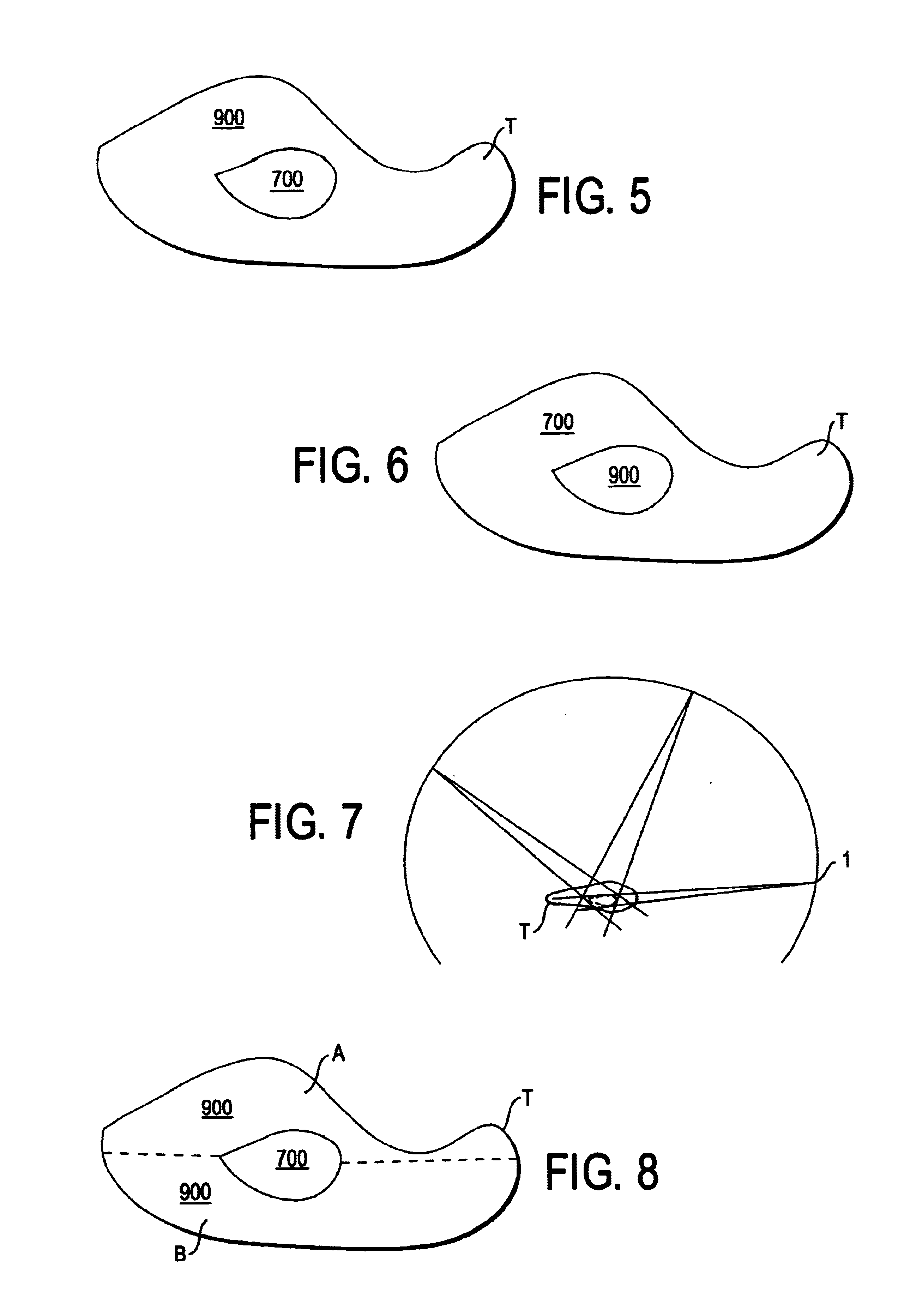 Method to control delivery of radiation therapy