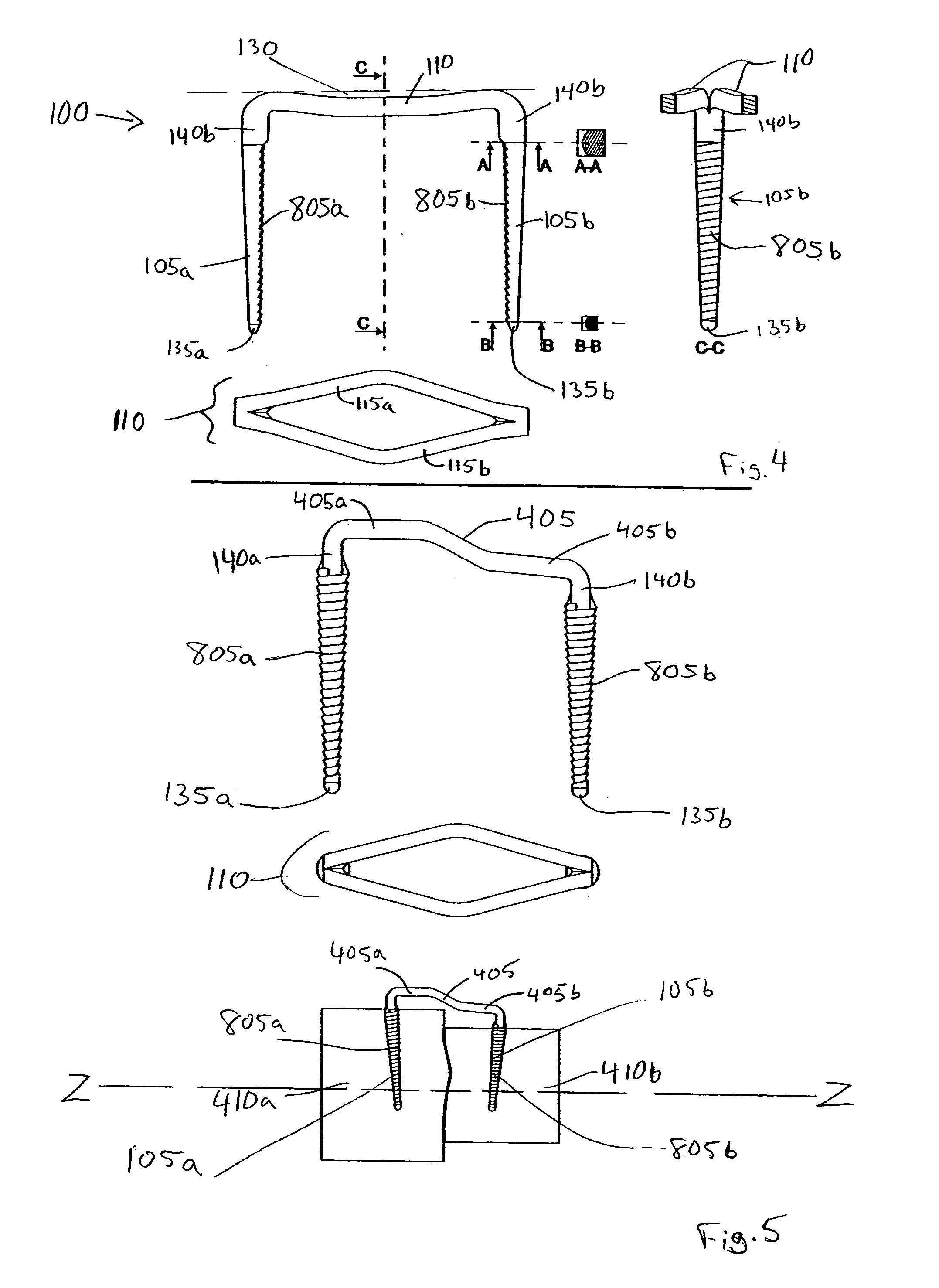 Osteosynthesis clip and insertion tool for inserting an osteosynthesis clip into bone tissue fragments