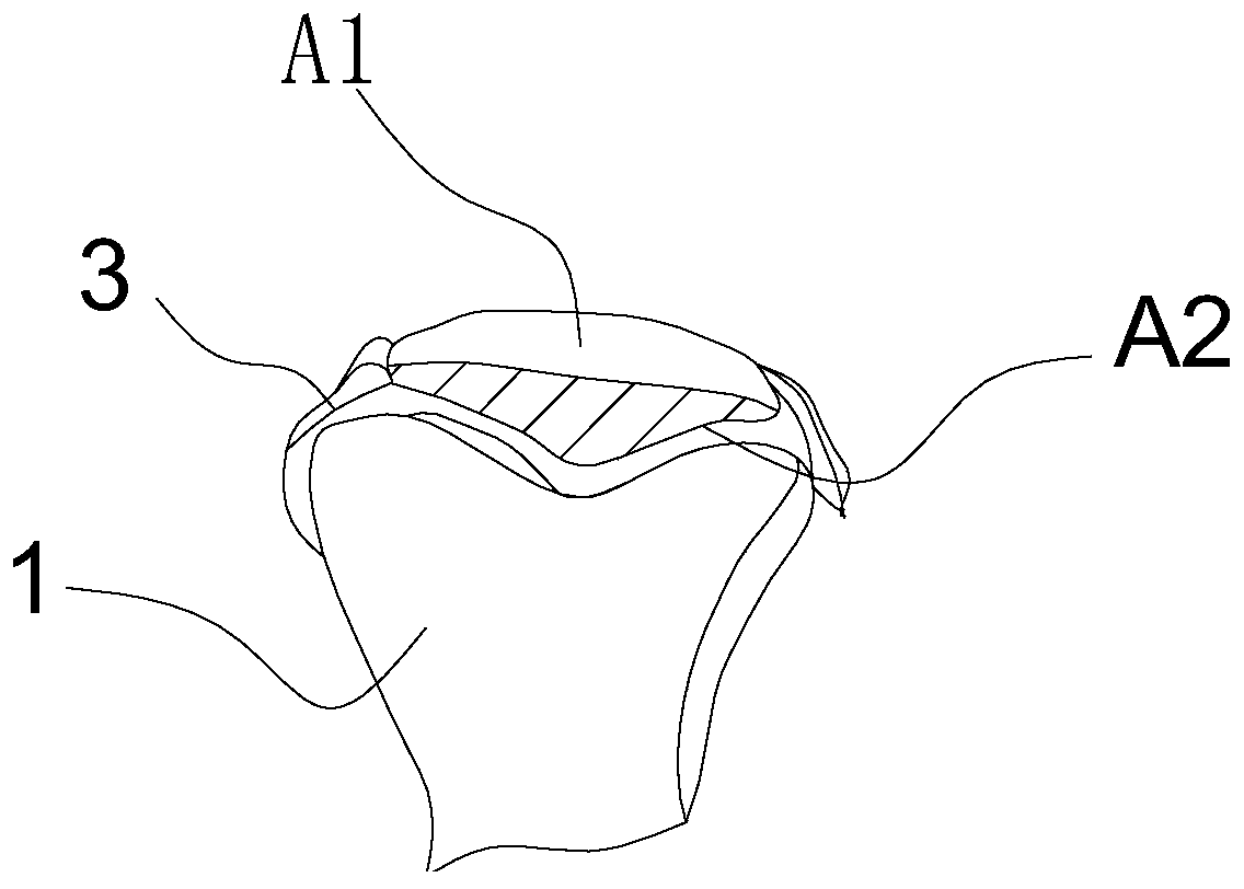 Design method of kneecap prosthesis