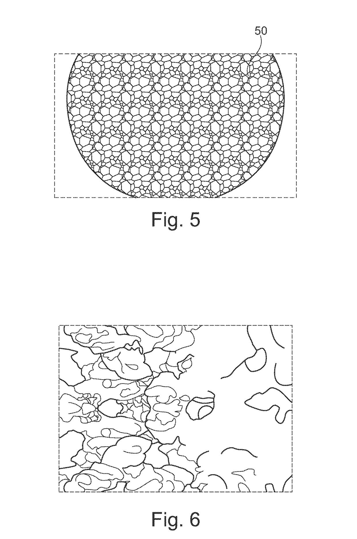 Biocompatible material in granules made of metal material or metal alloys and use of said granules for vertebroplasty