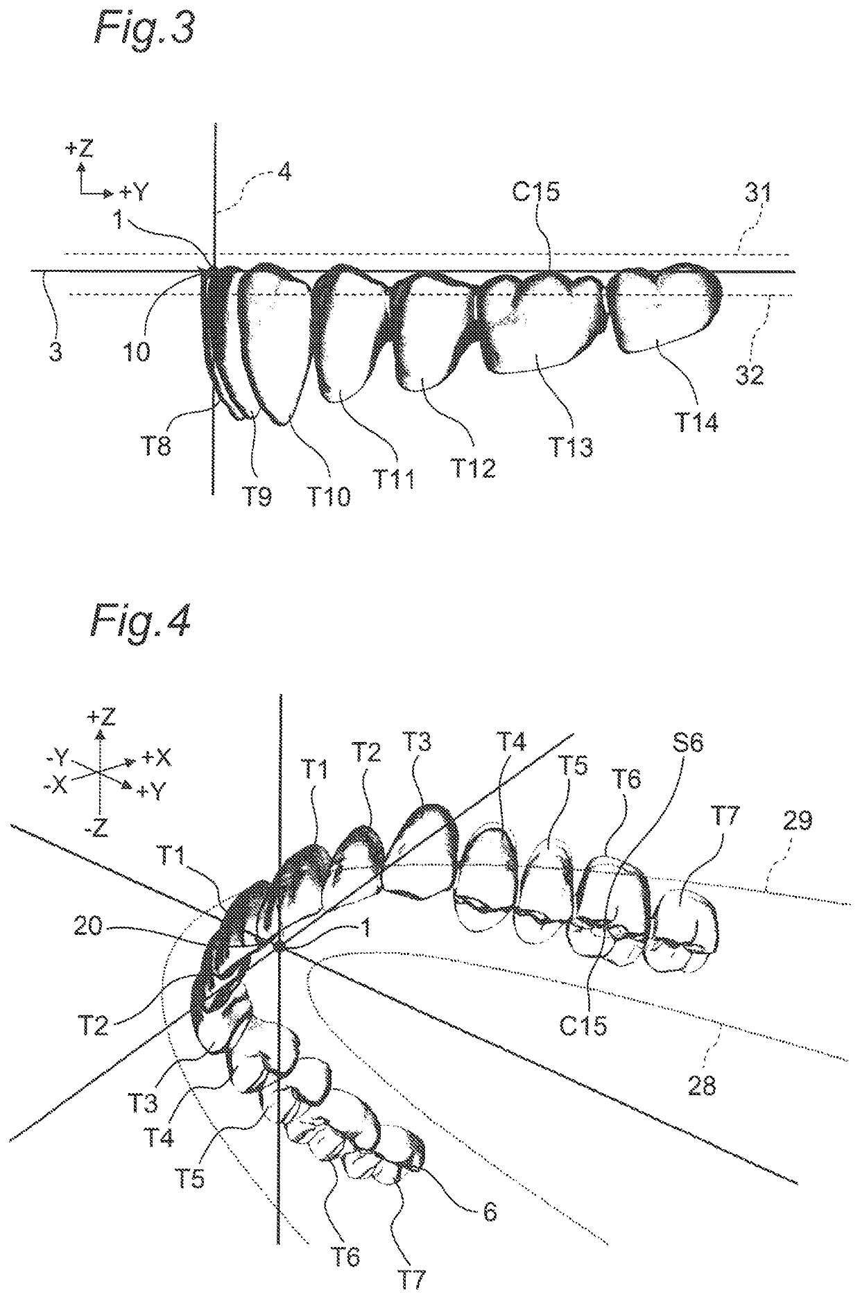 Artificial teeth set including mandibular coupled artificial teeth having an arch shape and maxillary coupled artificial teeth having an arch shape