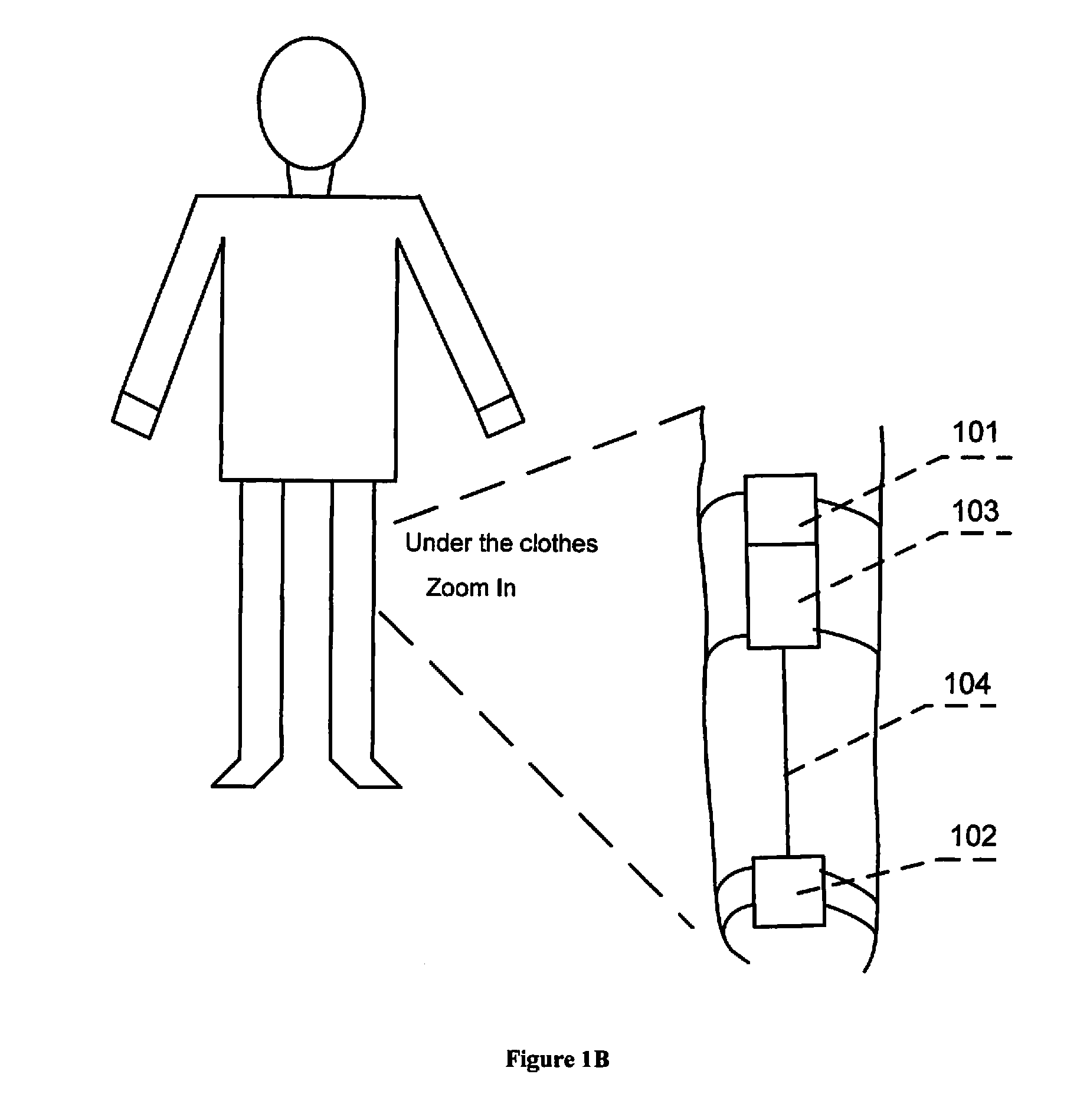 Metod and continuously wearable noninvasive apparatus for automatically detecting a stroke and other abnormal health conditions